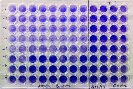 Inactivated virus